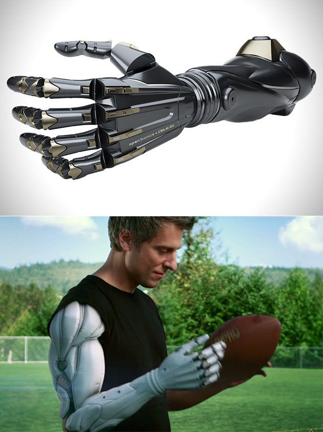 Deus X Bionic Arms