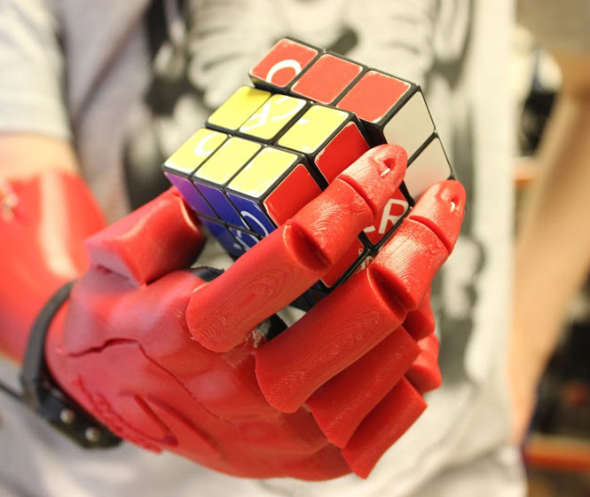 Open Bionics 3D-Printed Hand